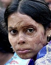 muslim acid attack