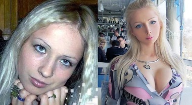 Valeria Lukyanova, BEFORE Plastic Surgery
