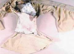 Underwear with explosive packet removed from alleged bomber Umar Farouk Abdulmutallab