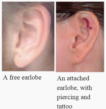earlobe types